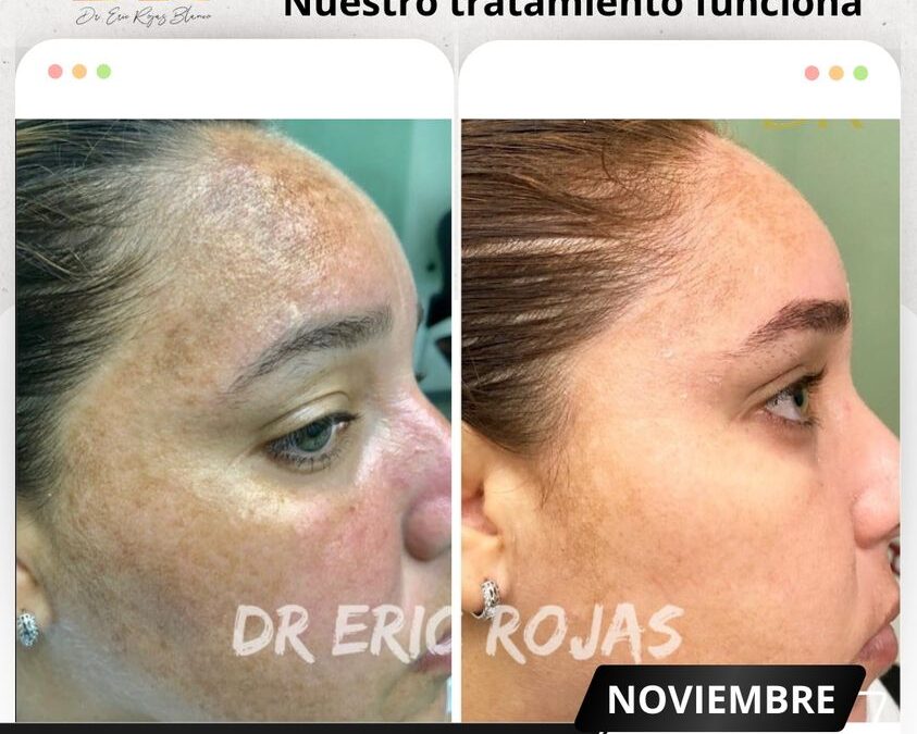 Tenemos la solución para limpiar tu rostro.