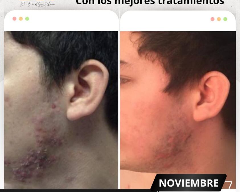 Limpia tu rostro y cambia tu vida.