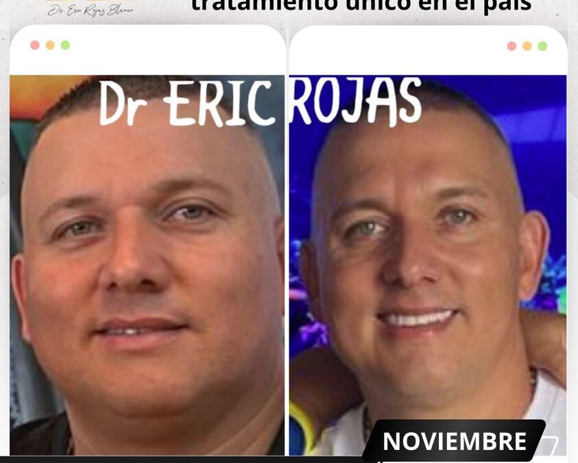 La mejor técnica para perder peso, solo en nuestra clínica.