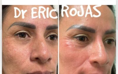 Rejuvenece tu rostro, contamos con el mejor tratamiento.