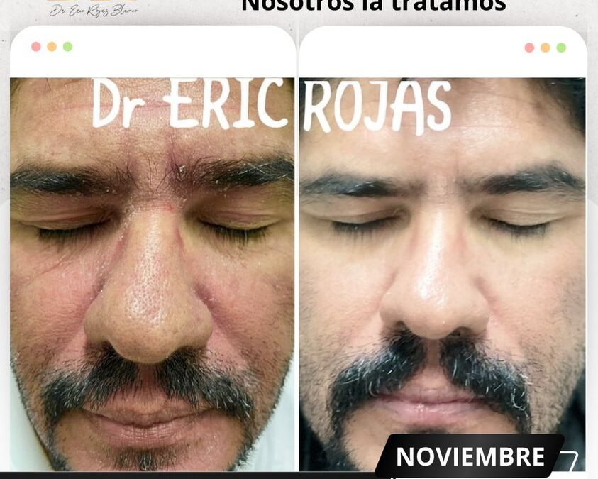 ¡Te ayudamos con tus problemas de piel!