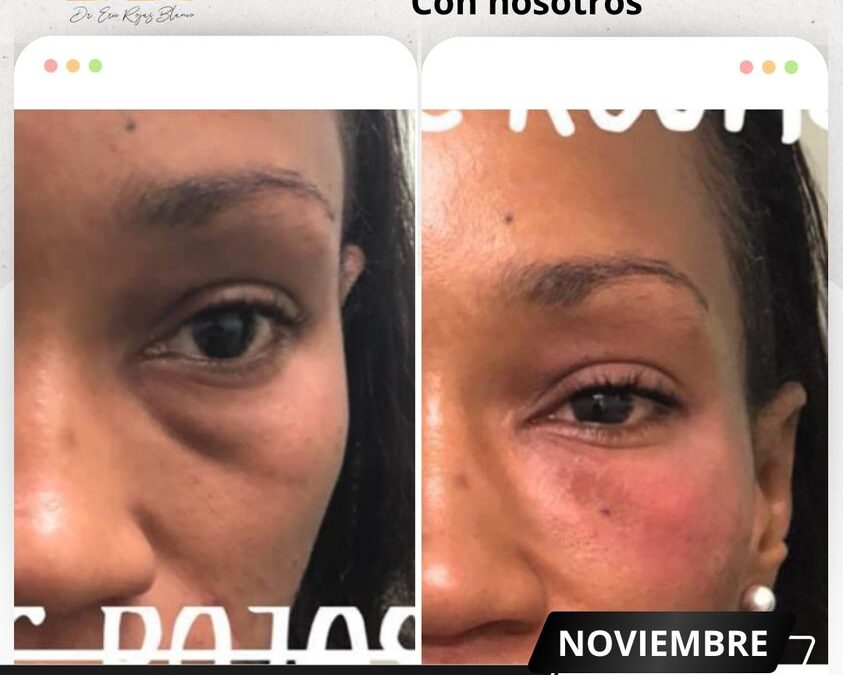 Rejuvenece tu rostro con técnicas únicas.👇😉