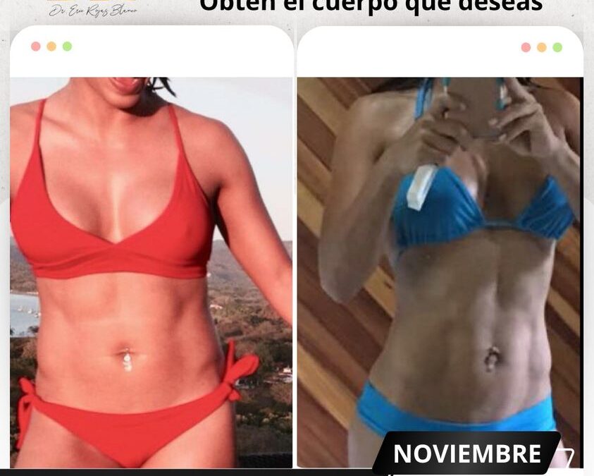 Slim Láser puede brindarle resultados fantasticos