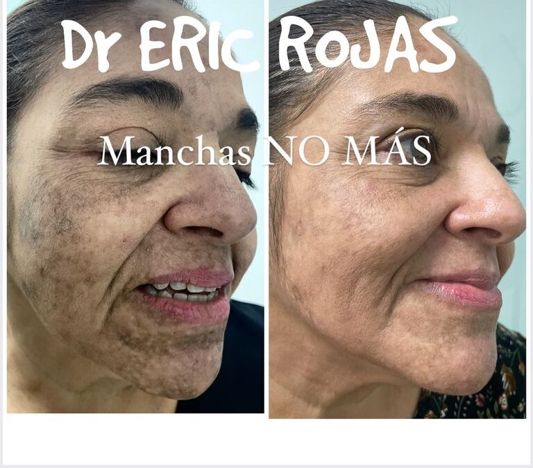 Búscanos 22483535