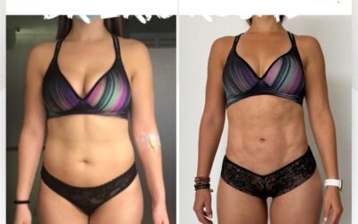 Slim láser Nueva Generación, realiza cambios increíbles.