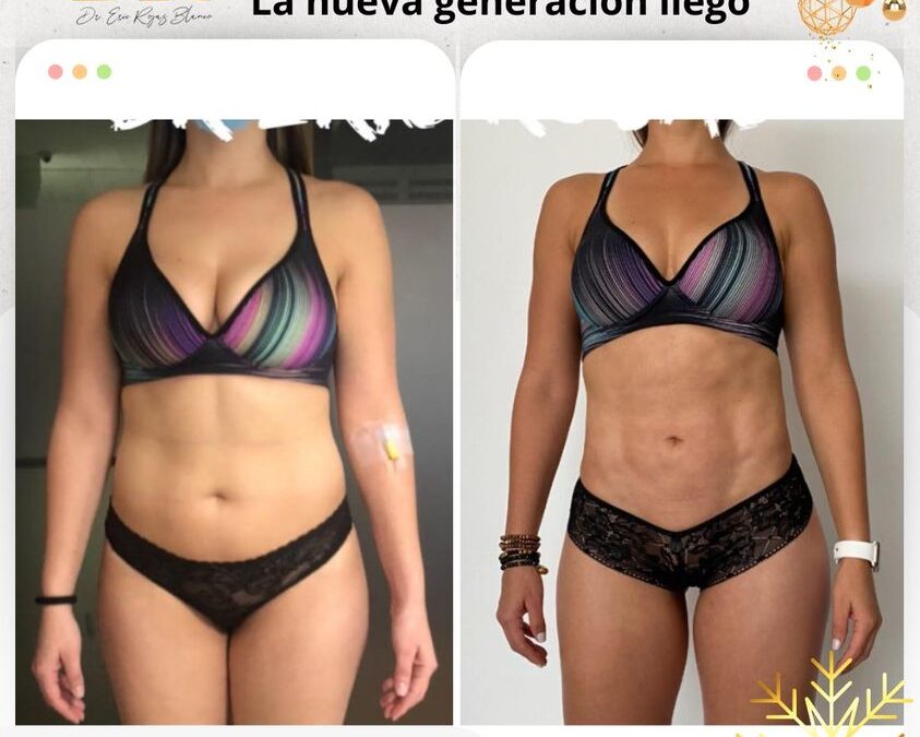 Slim láser Nueva Generación, realiza cambios increíbles.
