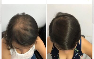 ¡Recupera tu cabello!👇😉