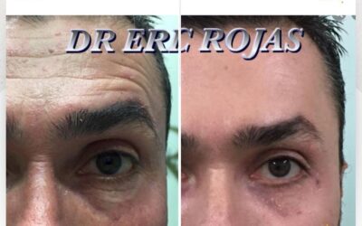 Rejuvenece tu rostro