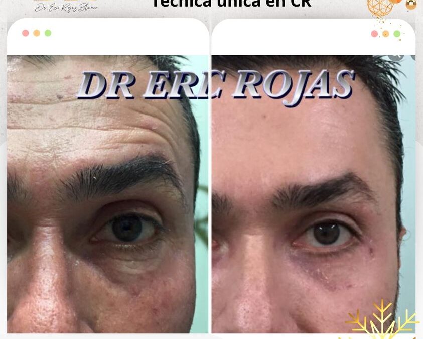 Rejuvenece tu rostro