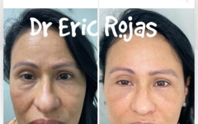 Devolver la sonrisa y el brillo a una bella mujer no tiene PRECIO