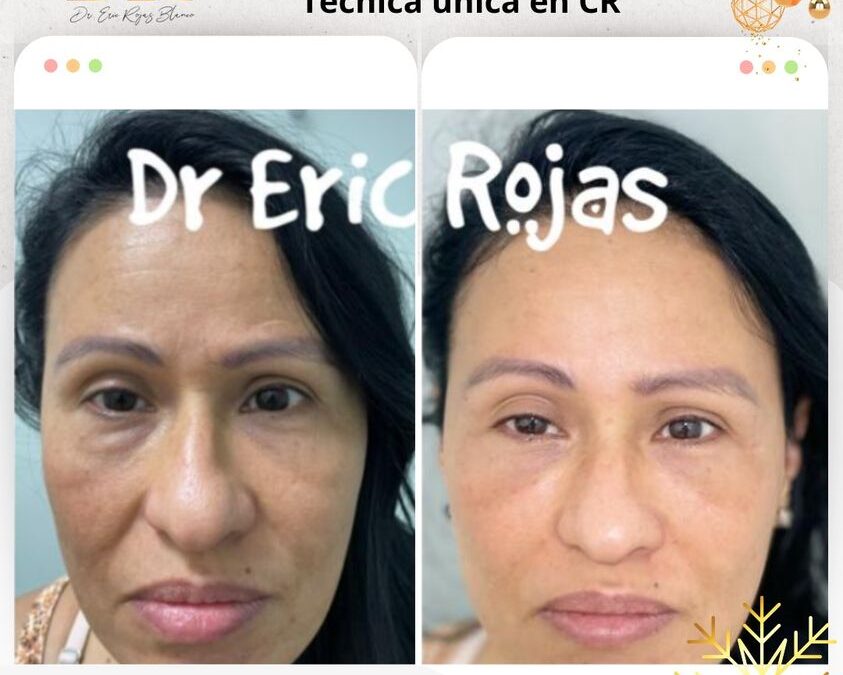 Devolver la sonrisa y el brillo a una bella mujer no tiene PRECIO