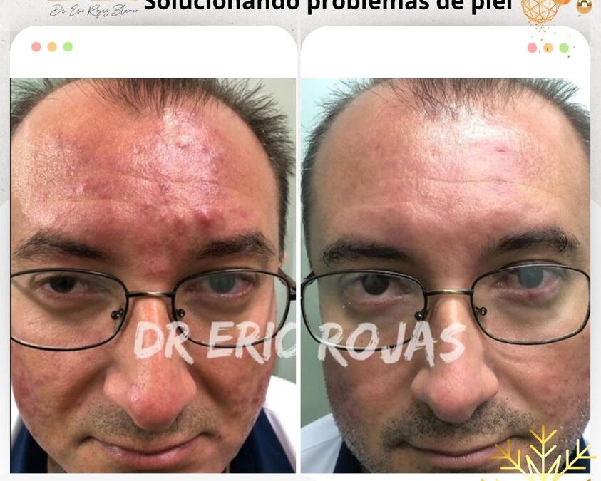 Somos expertos en todos los temas de piel, vísitanos