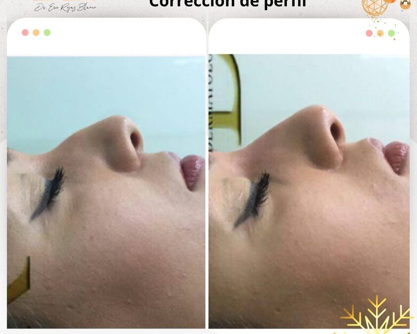 Corrige tu perfil con la mejor técnica