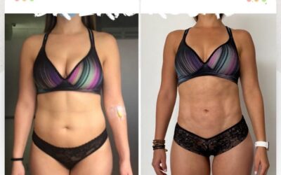 Slim láser Nueva Generación, realiza cambios increíbles