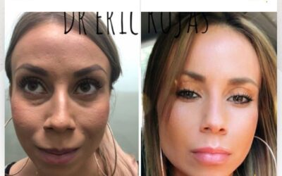 Refrescamiento facial