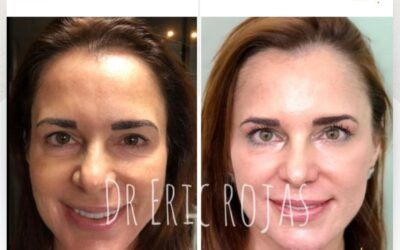 Devolver la sonrisa y el brillo a una bella mujer no tiene PRECIO.