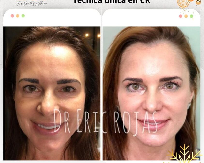 Devolver la sonrisa y el brillo a una bella mujer no tiene PRECIO.