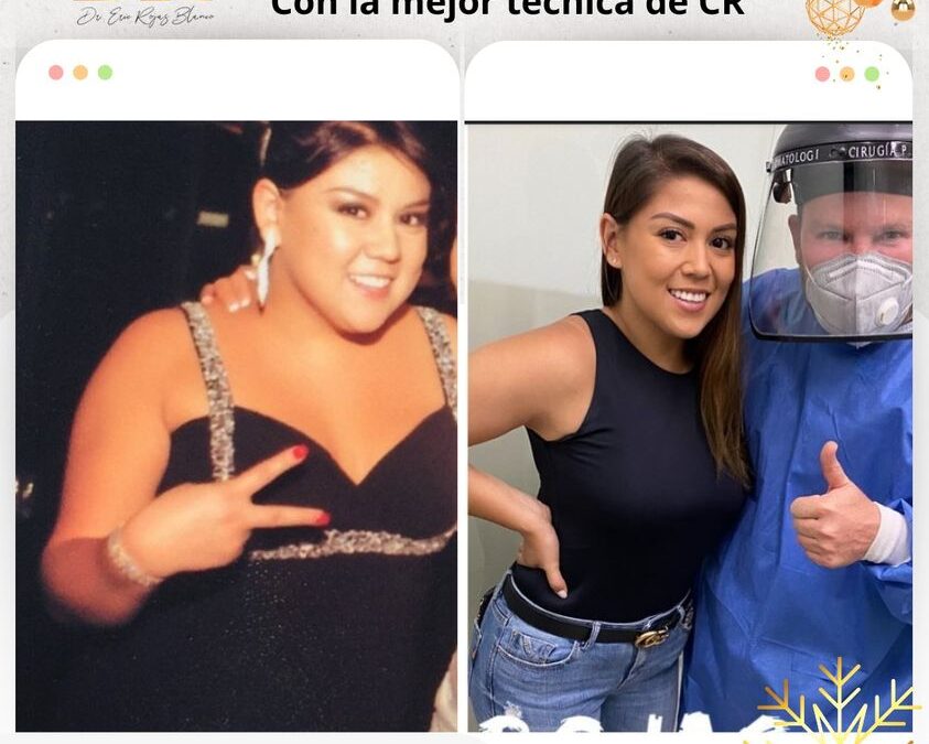 Baja de peso con el mejor tratamiento del país