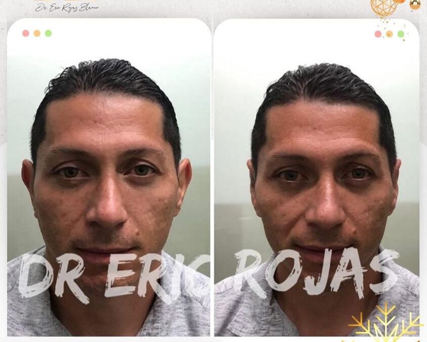 Corrige tus orejas con la mejor técnica