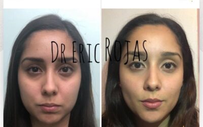 Perfilado facial con la mejor técnica