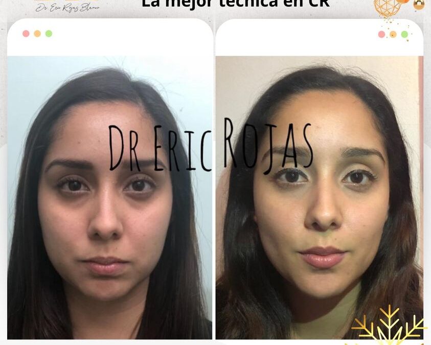 Perfilado facial con la mejor técnica