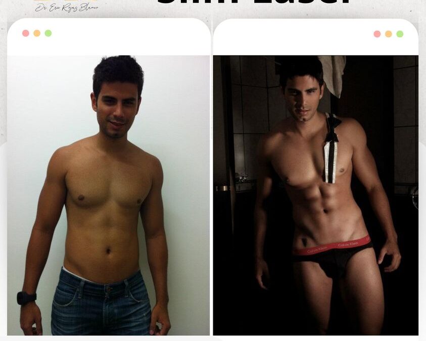 Slim Láser te brindará resultados magnificos
