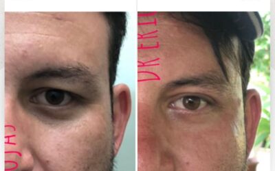 Rejuvenecimiento de rostro, no dudes en visitarnos.