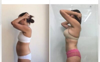 Slim Láser, increíbles cambios en tu cuerpo.