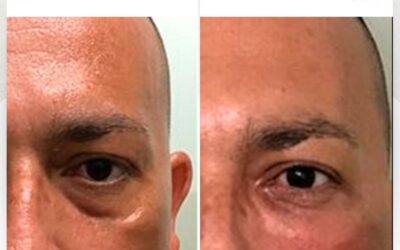 Refresca tu rostro y elimina las ojeras