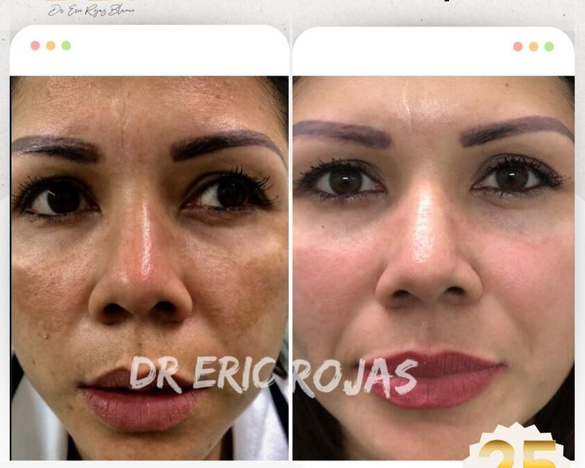Problemas con Manchas No Más… Tenemos la Solución.