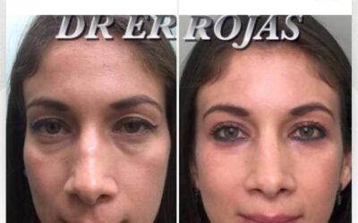 Tu rostro puede lucir más fresco cada día.
