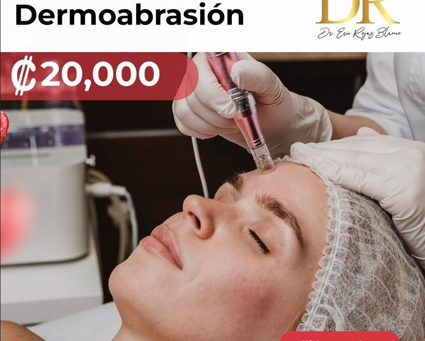 Este mes tenemos increíbles promociones para ti, Micro Dermoabrasión en 20,000 colones.