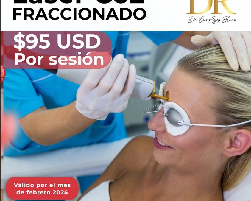 Este mes tenemos increíbles promociones para ti, Láser co2 fraccionado en $80 USD.