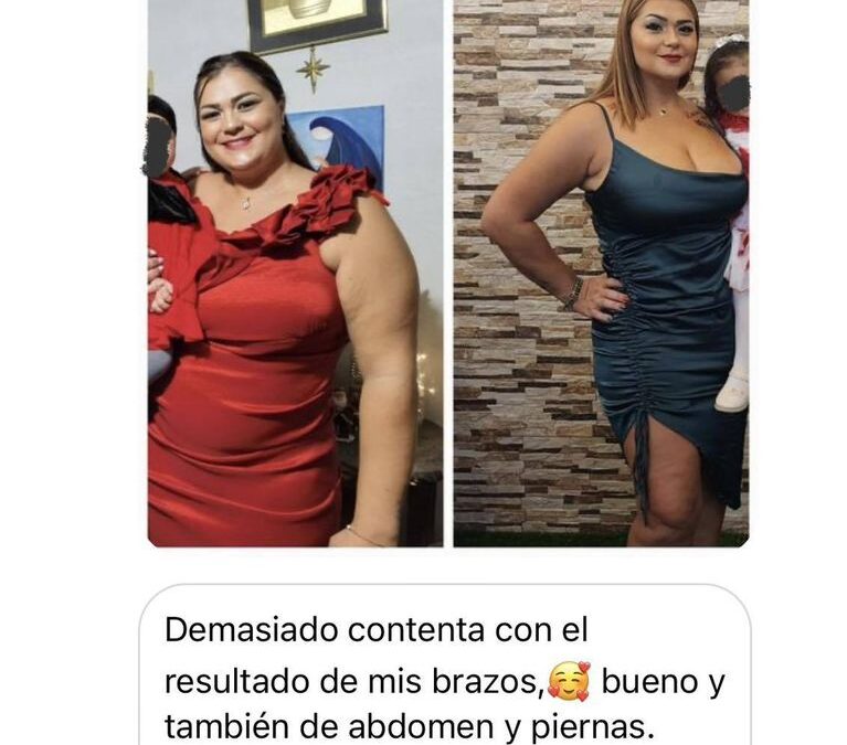 La alegría de ver a nuestros pacientes felices con Slim Láser.