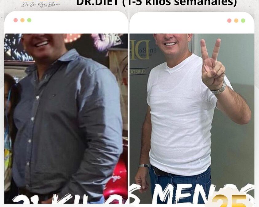 Pierde peso con el mejor procedimiento, ¿Qué esperas para realizar tu cambio este año?
