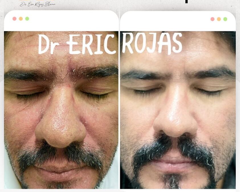Solucionamos todos tus problemas de piel.