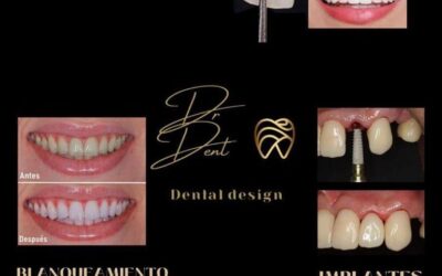 En Distrito médico tenemos Diseño de sonrisas en Dr.Dent