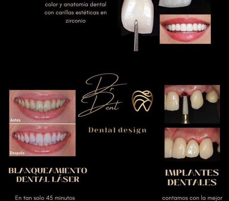 En Distrito médico tenemos Diseño de sonrisas en Dr.Dent