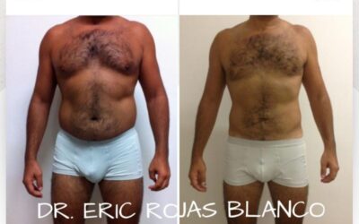 El Slim Láser genera estos increíbles cambios.