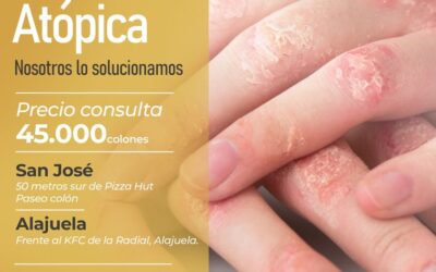 ¿Tienes dermatitis atópica?👇😉