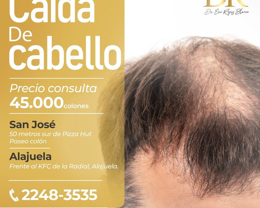 Detén la caída de cabello de tu vida, nosotros te damos la solución.