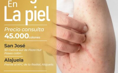 ¿Tienes alergias en tu piel?, nosotros te ayudamos.