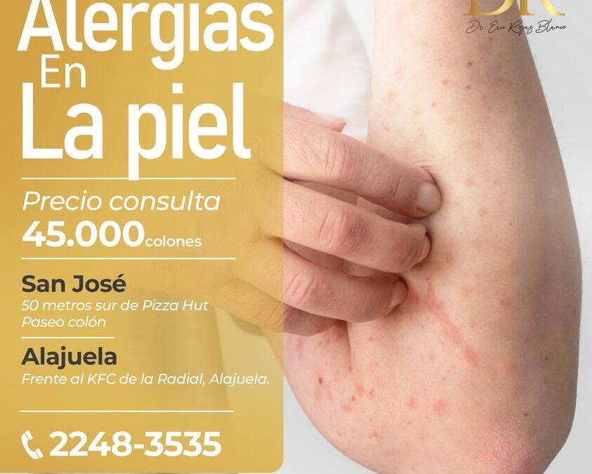 ¿Tienes alergias en tu piel?, nosotros te ayudamos.