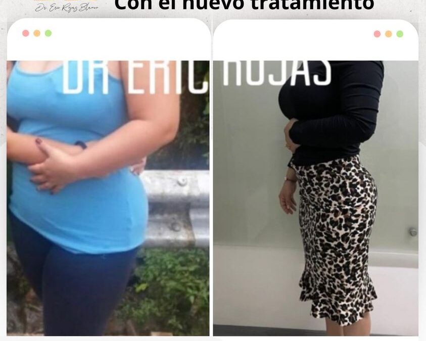 Con la mejor técnica del país puedes perder peso.