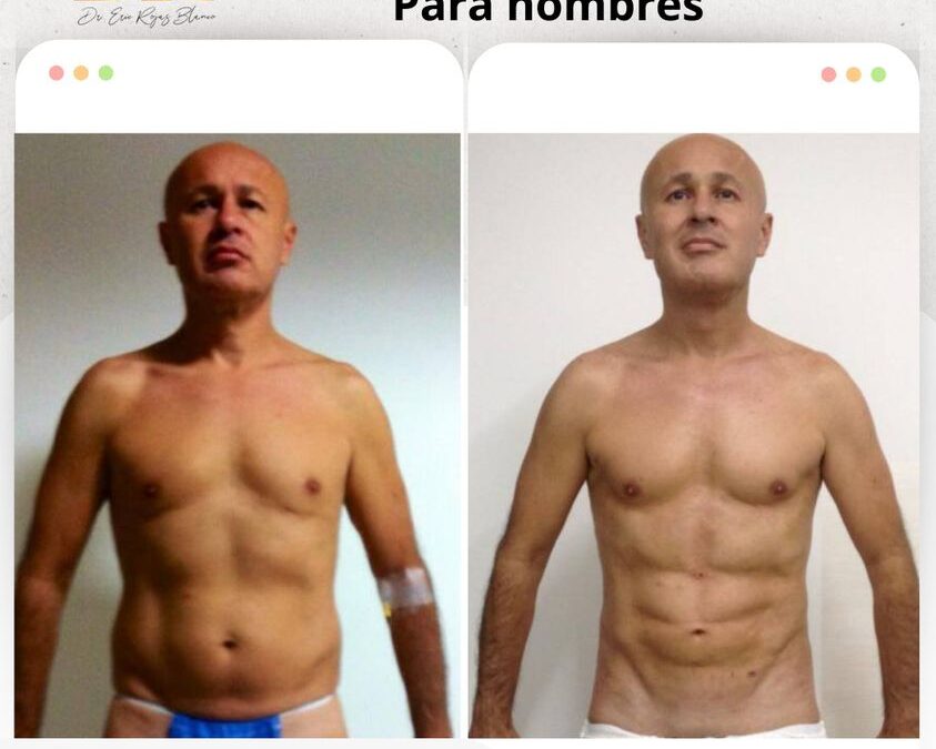 Increíble procedimiento para hombres.