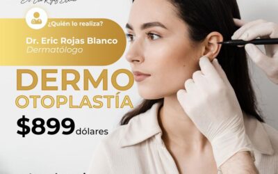 Dermo Otoplastía es la técnica ideal para la correción de tus orejas.