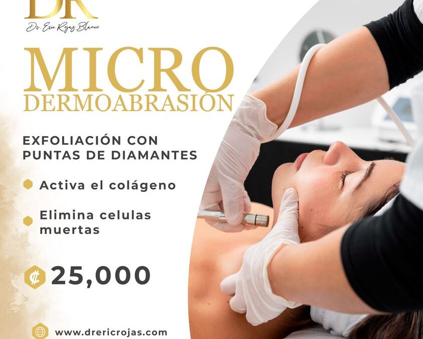 Micro-dermoabrasión, cuida tu rostro.