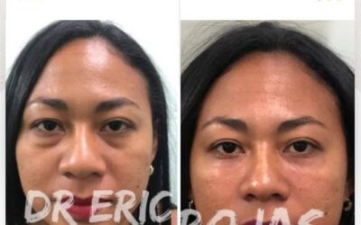 Dile adiós a tus ojeras.👇😉