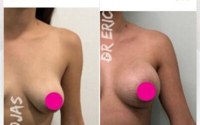 Devolver la sonrisa y el brillo a una bella mujer no tiene PRECIO