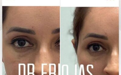 Dermo Otoplastia en promoción, no pierdas la oportunidad.